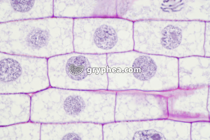 Mitose dans une racine de Blé (cellules-filles) x200 - gryphea.com